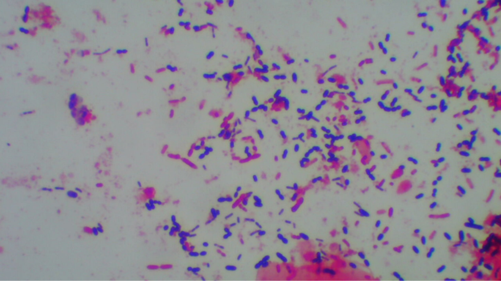 細菌のグラム染色