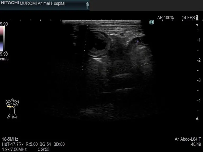 膵炎エコー画像